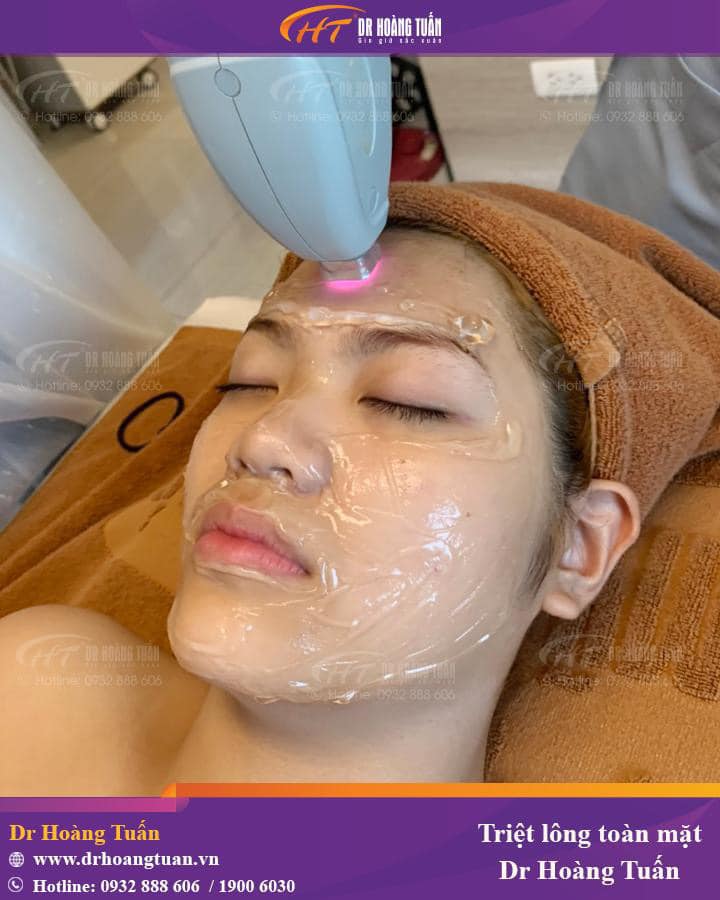 Triệt lông vĩnh viễn có hết không